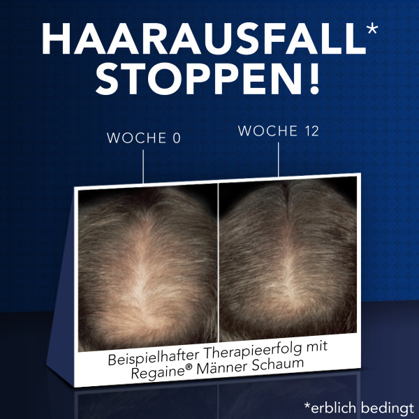 REGAINE® Männer Schaum mit Minoxidil